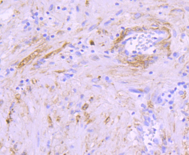 Anti-CRYAB Antibody (6W222)