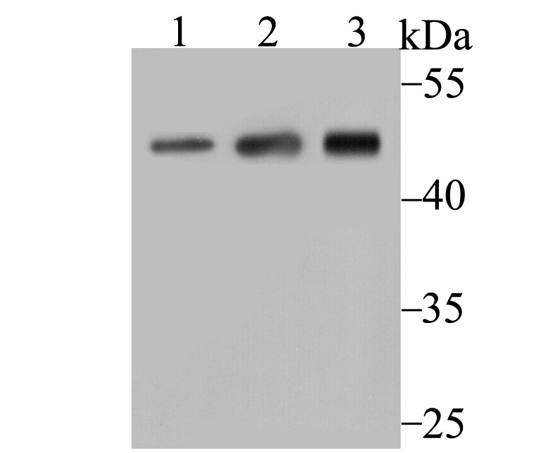 Anti-Arp3/ACTR3 Antibody (1Q436)