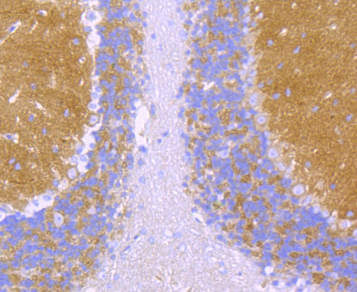 Anti-SPTAN1 Antibody (8O990)