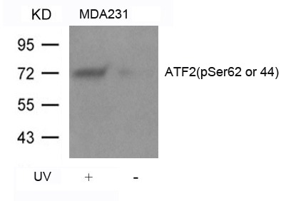 Anti-Phospho-ATF2 (Ser62 or 44) Polyclonal Antibody