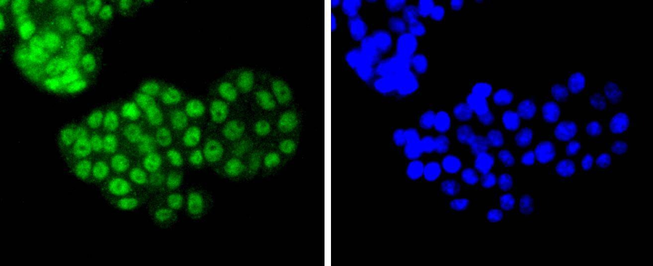 Anti-ATF2 Antibody (4L818)