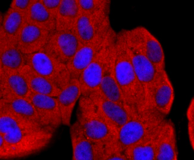 Anti-Argonaute-2 Antibody (1L369)