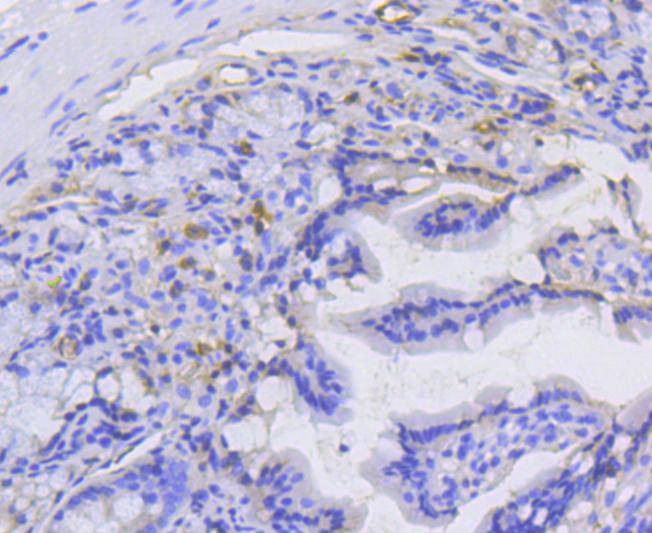 Anti-alpha 1 Catenin Antibody (9R277)