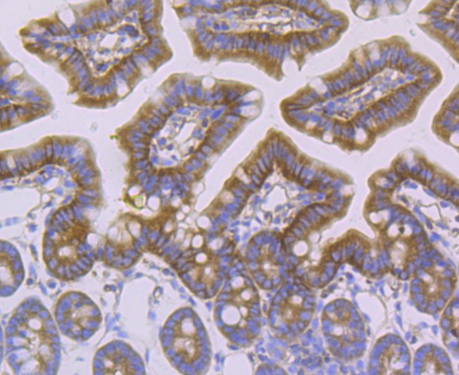 Anti-alpha Actinin 4 Antibody (7D211)