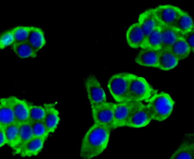 Anti-alpha Actinin 4 Antibody (7D211)