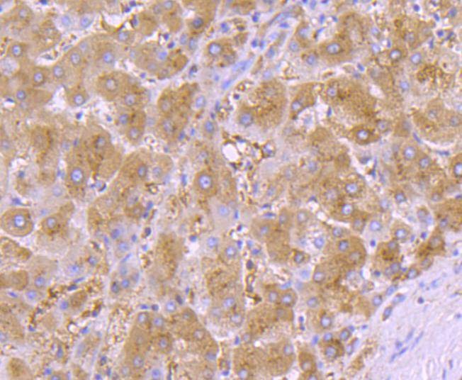 Anti-Serpin A1 Antibody (8W352)