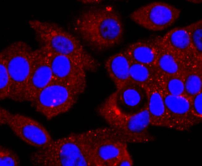 Anti-Serpin A1 Antibody (8W352)