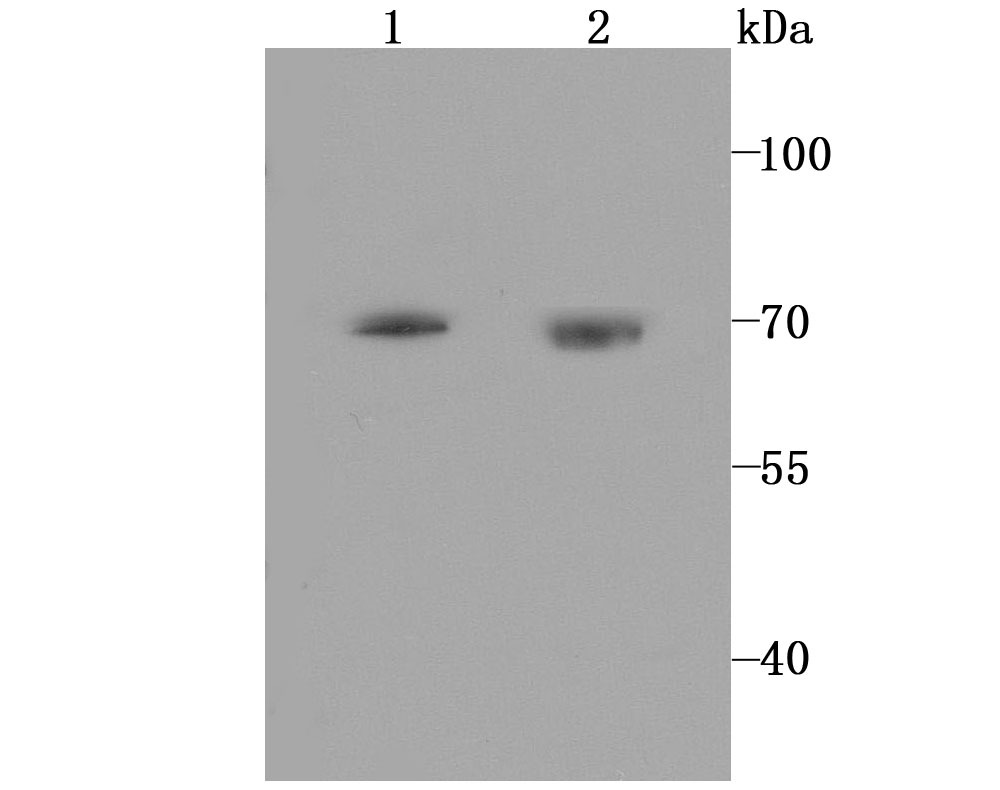 Anti-HTR2C Antibody (5H488)