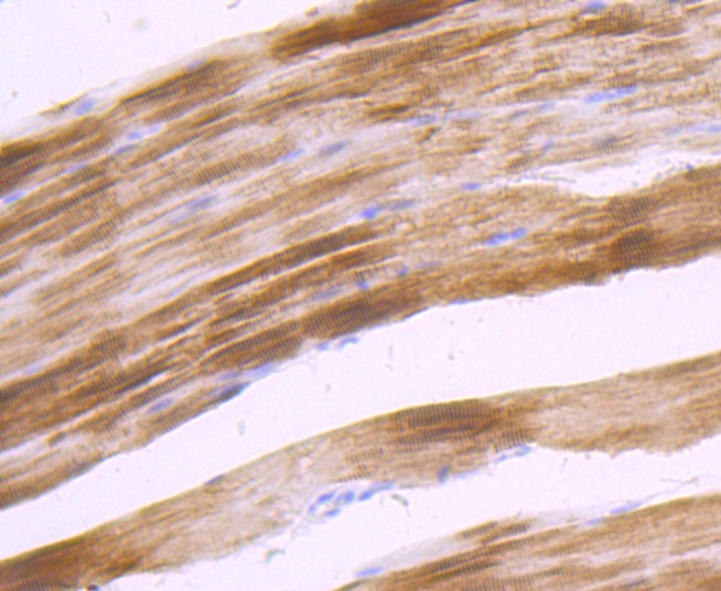 Anti-Alpha Actinin 2 Antibody (2O342)