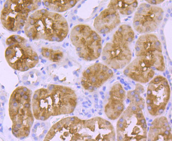 Anti-FTCD Antibody (8U835)