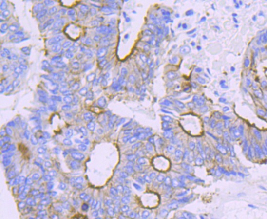 Anti-alpha Actinin 4 Antibody (7D211)