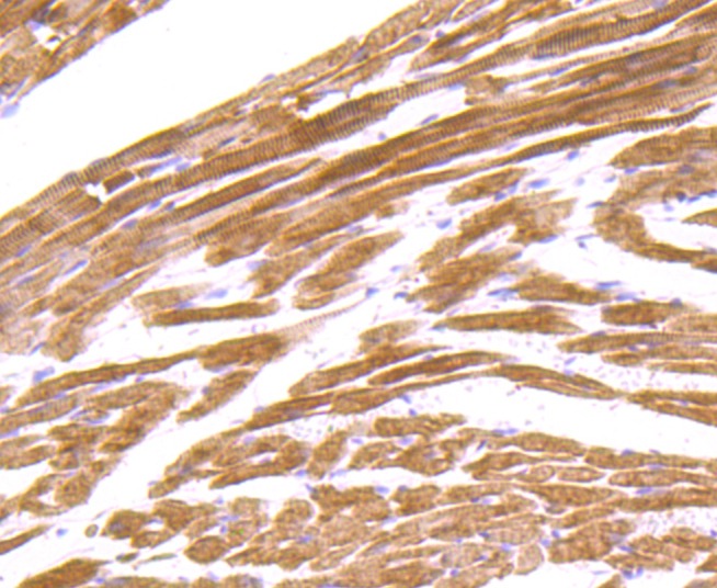 Anti-Alpha Actinin 2 Antibody (2O342)