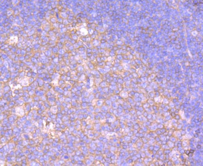 Anti-Serpin A1 Antibody (8W352)
