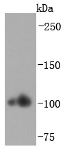 Anti-Alpha Actinin 2 Antibody (2O342)