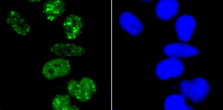 Anti-53BP1 Antibody (3K586)