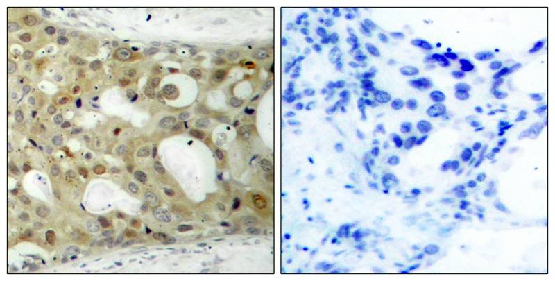 Anti-Phospho-Androgen receptor (Ser650) Polyclonal Antibody 2