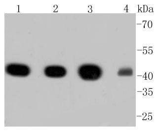 Anti-ACTA2 Antibody (1S368)