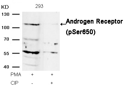 Anti-Phospho-Androgen receptor (Ser650) Polyclonal Antibody 2