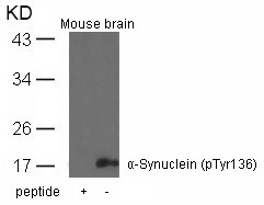 Anti-Phospho-Alpha-Synuclein (Tyr136) Polyclonal Antibody