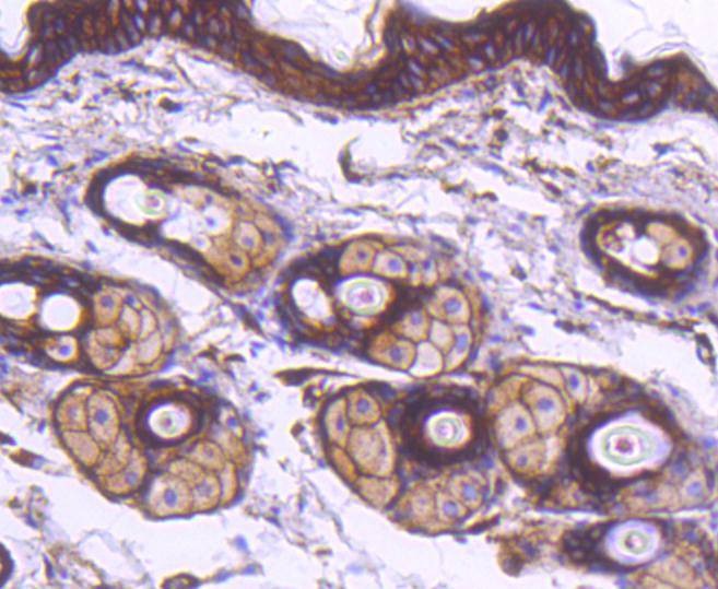 Anti-ACTA2 Antibody (1S368)