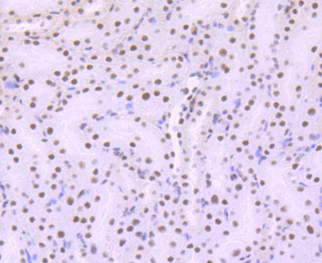 Anti-ARID1A Antibody (2S979)