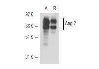Anti-ANGPT2/Angiopoietin-2 Antibody (5L463)