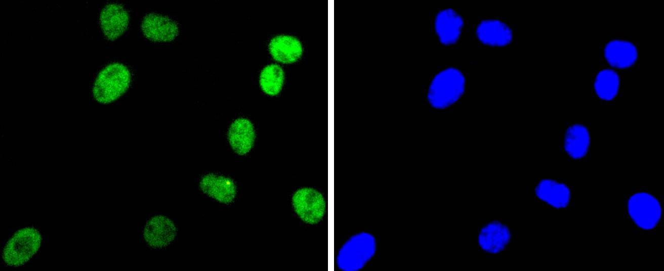Anti-ARID1A Antibody (2S979)