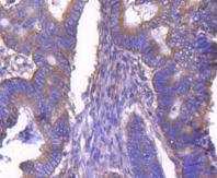 Anti-ARF1 Antibody (3P306)
