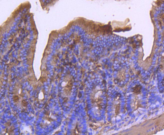 Anti-ACTA2 Antibody (1S368)