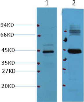 Anti-AMACR Antibody (4Y618)