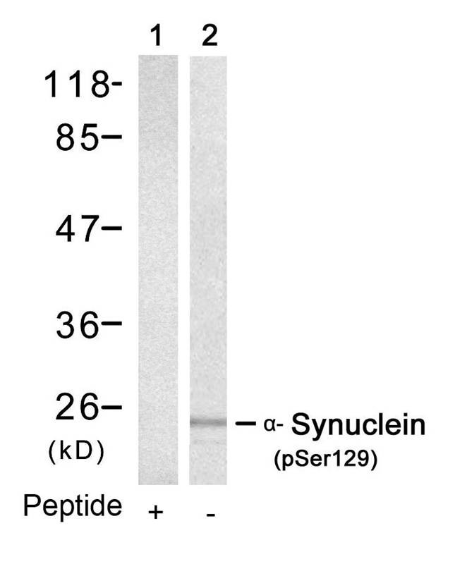 Anti-Phospho-Alpha-Synuclein (Ser129) Polyclonal Antibody