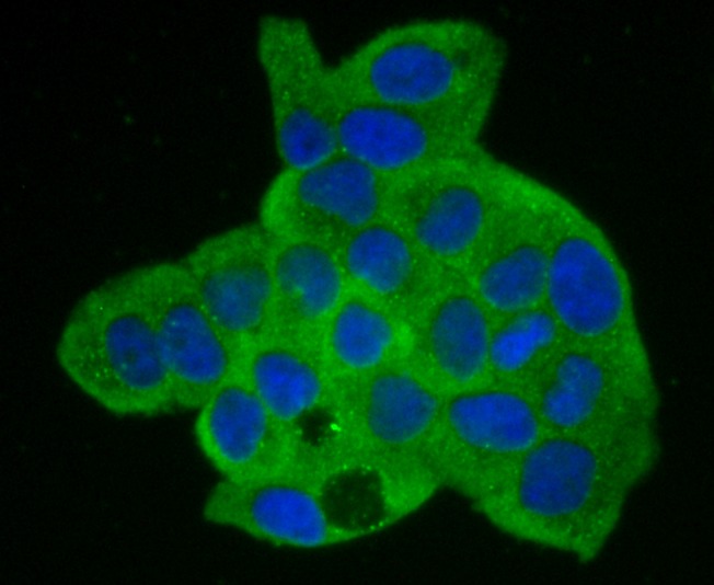 Anti-ANXA2 Antibody (4Q629)