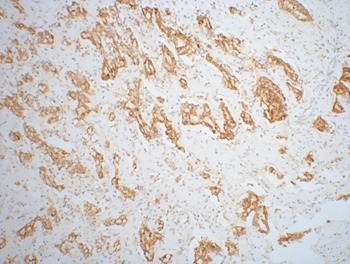 Anti-AMACR Antibody (4Y618)