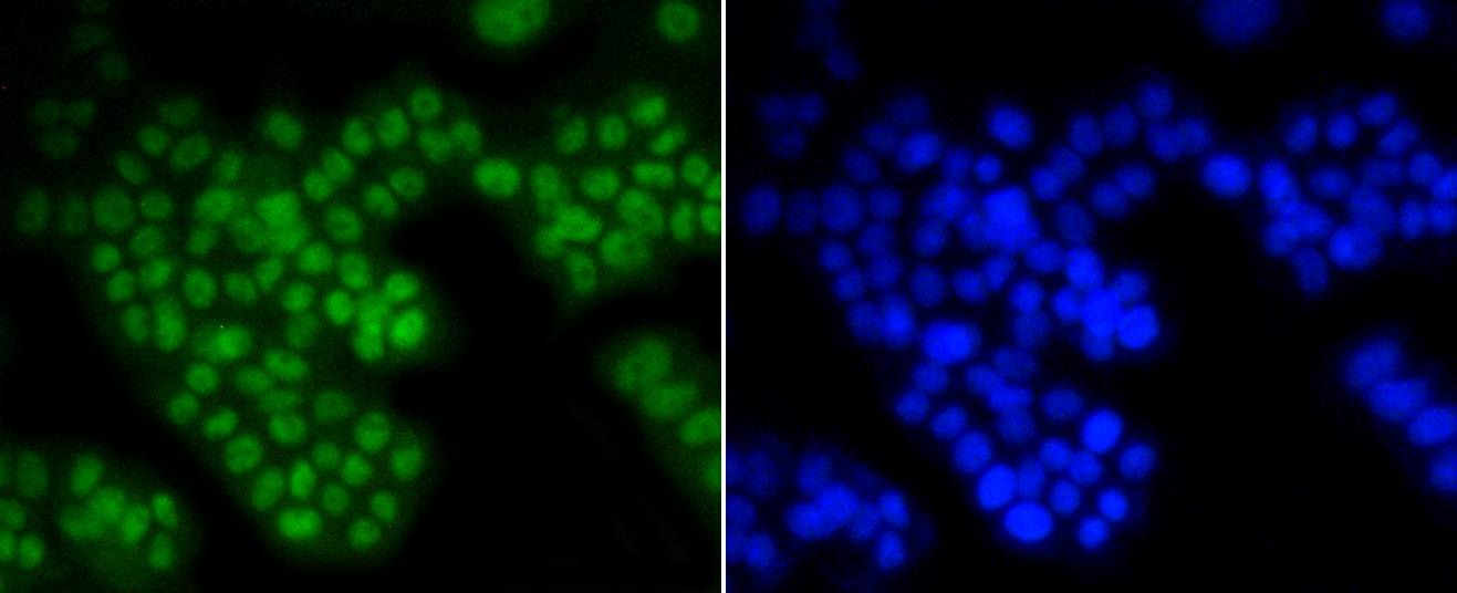 Anti-ASH2L Antibody (4J278)