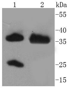 Anti-Arginase 1/ARG1 Antibody (3B969)