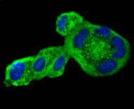 Anti-AGT Antibody (1Z261)