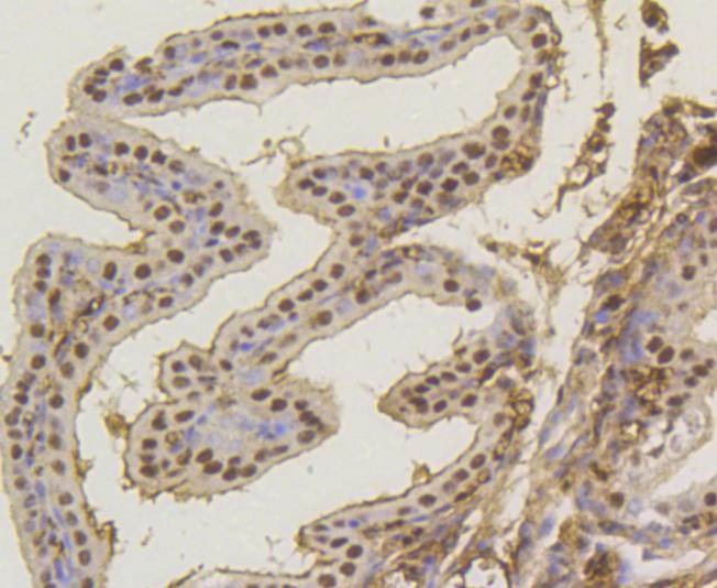 Anti-ASH2L Antibody (4J278)