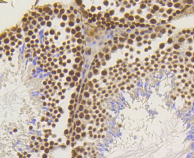 Anti-ASH2L Antibody (4J278)