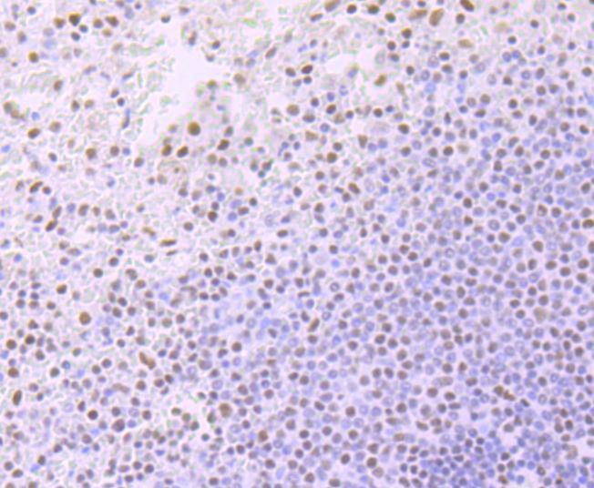 Anti-ARID1A Antibody (2S979)