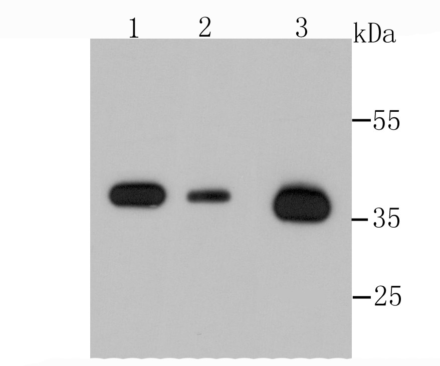 Anti-ANXA2 Antibody (4Q629)