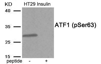 Anti-Phospho-ATF1 (Ser63) Polyclonal Antibody