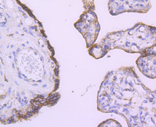 Anti-ANGPT2/Angiopoietin-2 Antibody (6W480)