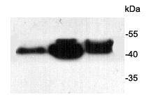 Anti-ACTA2 Antibody (1X82)