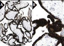 Anti-ANGPT2/Angiopoietin-2 Antibody (5L463)