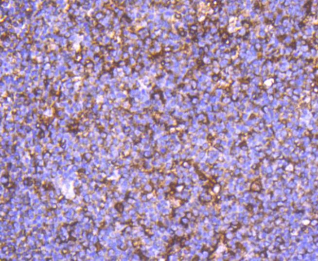 Anti-ACTA2 Antibody (1S368)