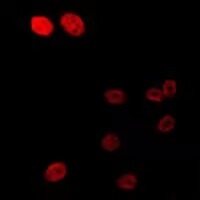 Anti-Phospho-Androgen receptor (Ser213) Polyclonal Antibody 2