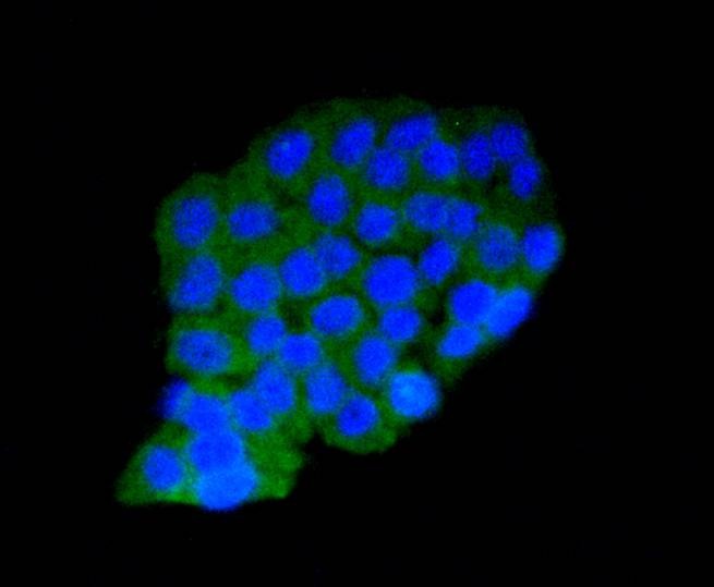 Anti-AMPK α1 Antibody (7H670)