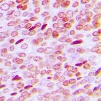 Anti-Phospho-Androgen receptor (Ser213) Polyclonal Antibody 2