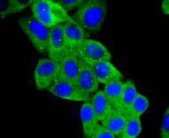 Anti-AGT Antibody (1Z261)
