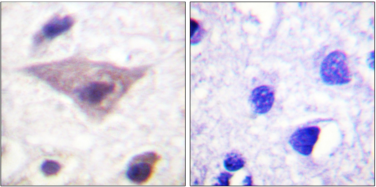 Anti-Phospho-Alpha-Synuclein (Ser129) Polyclonal Antibody